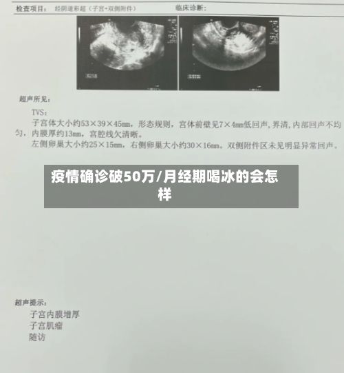 疫情确诊破50万/月经期喝冰的会怎样-第3张图片