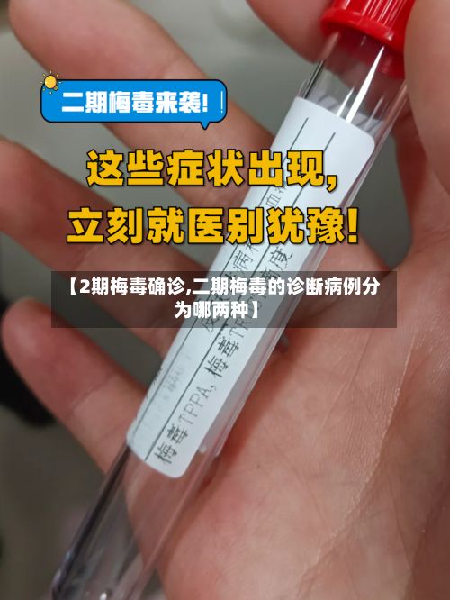 【2期梅毒确诊,二期梅毒的诊断病例分为哪两种】-第2张图片