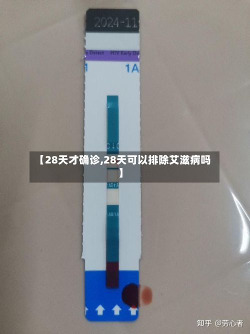 【28天才确诊,28天可以排除艾滋病吗】-第2张图片