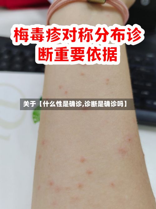 关于【什么性是确诊,诊断是确诊吗】