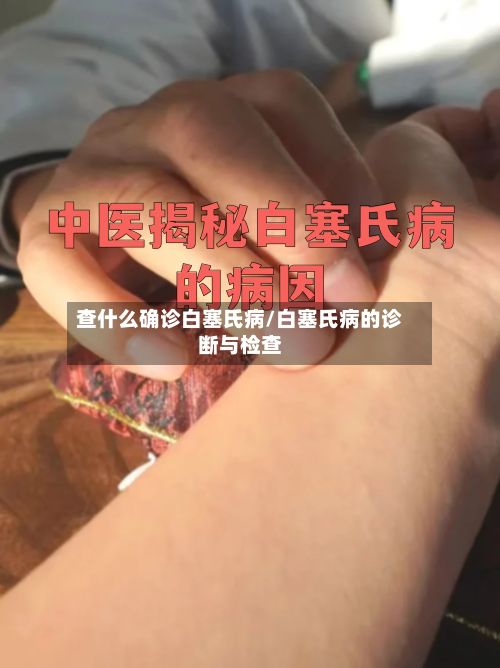 查什么确诊白塞氏病/白塞氏病的诊断与检查