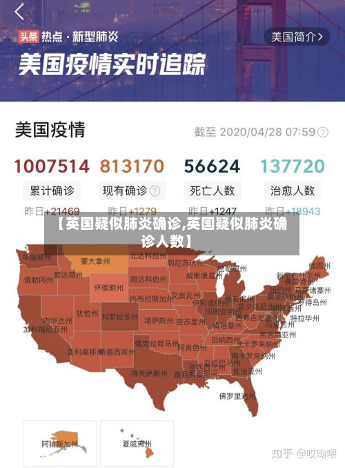 【英国疑似肺炎确诊,英国疑似肺炎确诊人数】-第2张图片