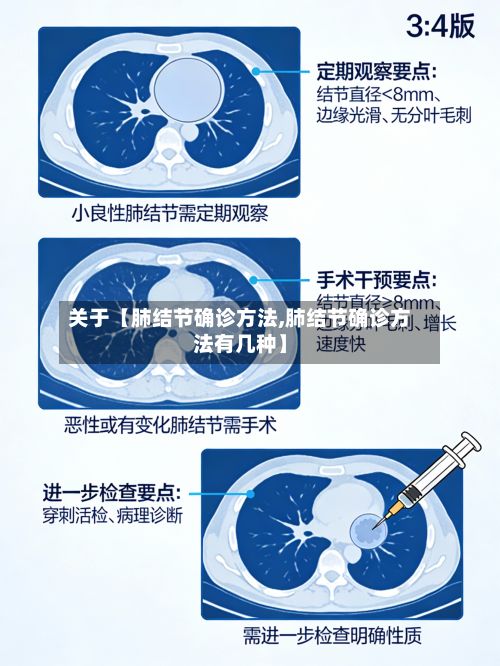 关于【肺结节确诊方法,肺结节确诊方法有几种】