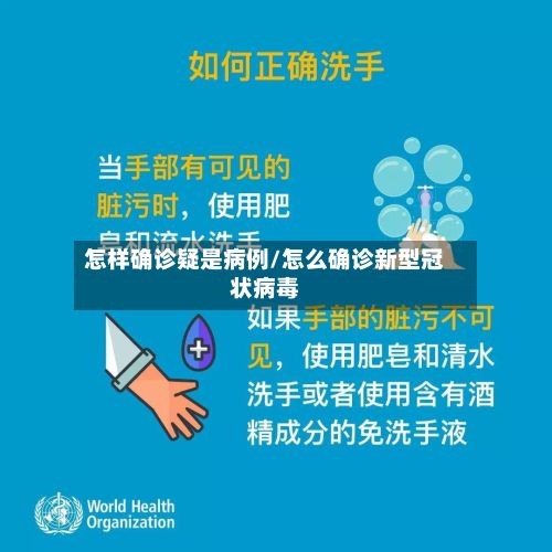 怎样确诊疑是病例/怎么确诊新型冠状病毒-第2张图片