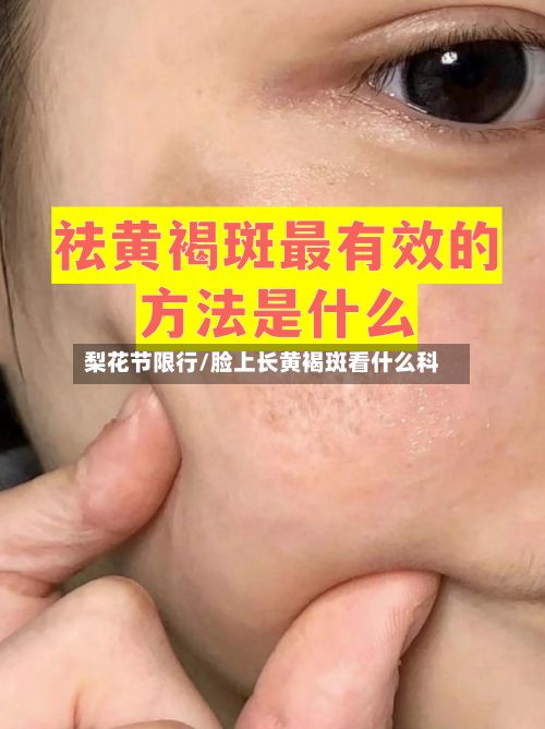 梨花节限行/脸上长黄褐斑看什么科-第2张图片