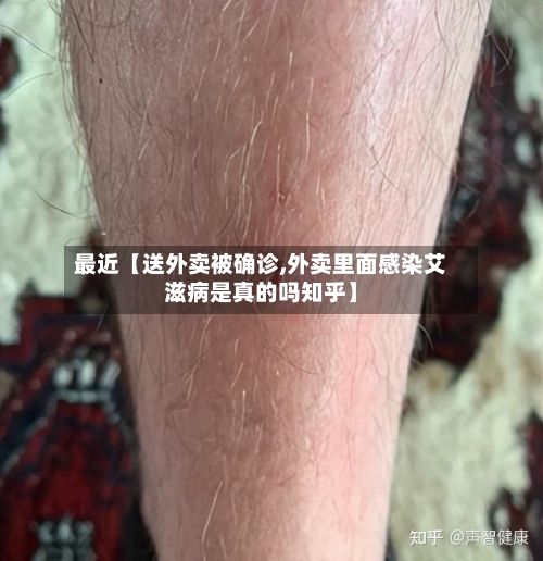 最近【送外卖被确诊,外卖里面感染艾滋病是真的吗知乎】