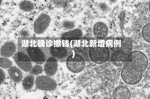 湖北确诊撒钱(湖北新增病例)-第2张图片
