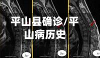 平山县确诊/平山病历史-第3张图片