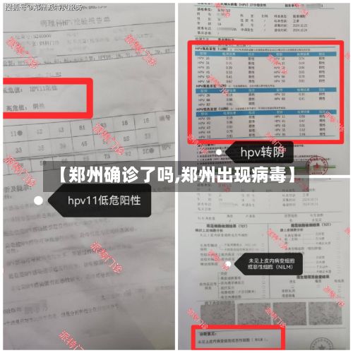 【郑州确诊了吗,郑州出现病毒】-第2张图片