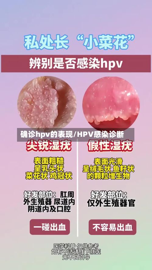 确诊hpv的表现/HPV感染诊断-第2张图片
