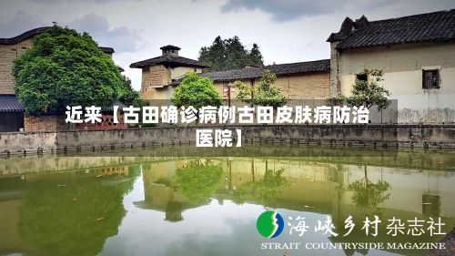 近来【古田确诊病例古田皮肤病防治医院】-第3张图片