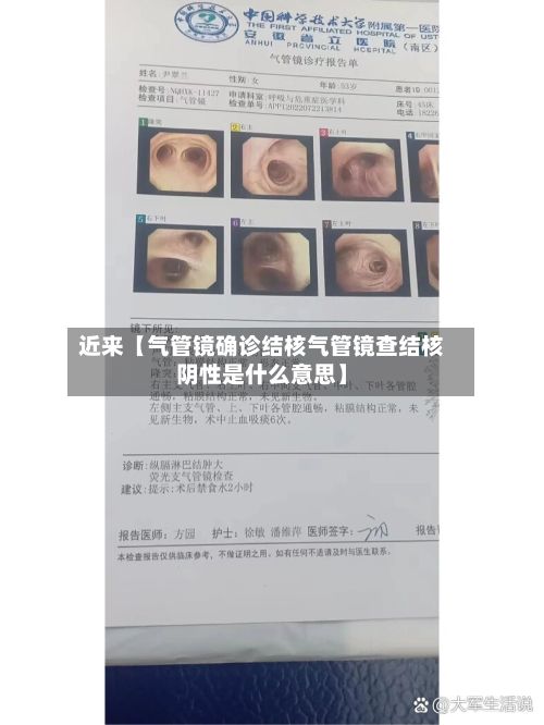 近来【气管镜确诊结核气管镜查结核阴性是什么意思】-第2张图片