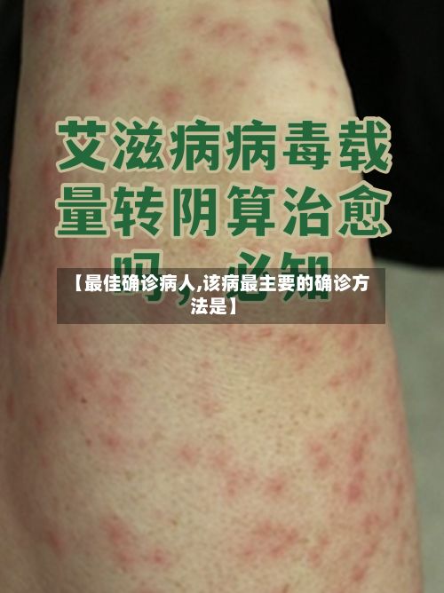 【最佳确诊病人,该病最主要的确诊方法是】