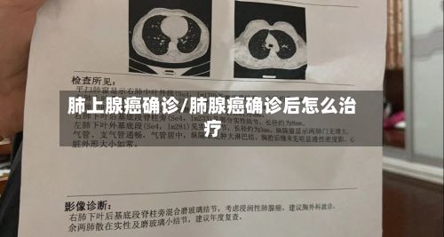 肺上腺癌确诊/肺腺癌确诊后怎么治疗