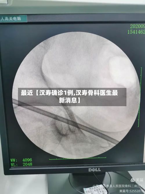 最近【汉寿确诊1例,汉寿骨科医生最新消息】