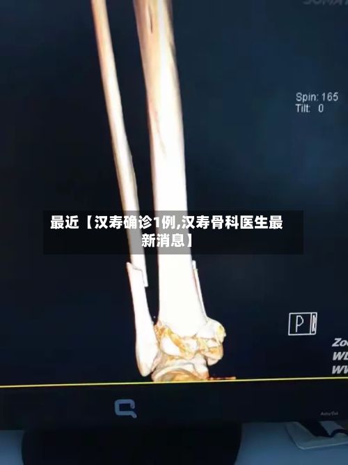 最近【汉寿确诊1例,汉寿骨科医生最新消息】-第2张图片