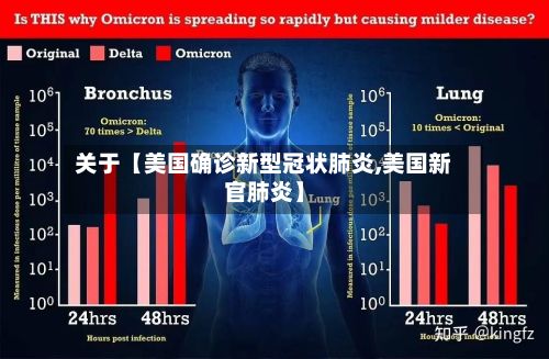 关于【美国确诊新型冠状肺炎,美国新官肺炎】-第3张图片