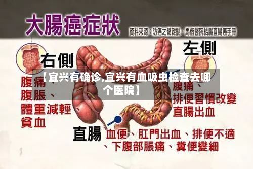 【宜兴有确诊,宜兴有血吸虫检查去哪个医院】-第2张图片
