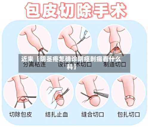 近来【阴茎疼怎确诊阴痉刺痛看什么科】