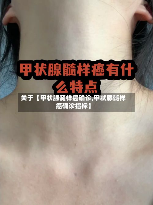 关于【甲状腺髓样癌确诊,甲状腺髓样癌确诊指标】-第2张图片