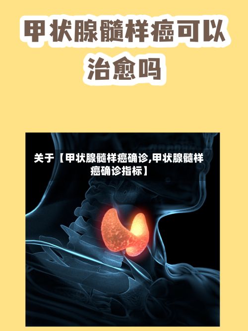 关于【甲状腺髓样癌确诊,甲状腺髓样癌确诊指标】-第3张图片