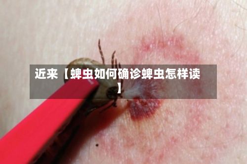 近来【蜱虫如何确诊蜱虫怎样读】-第2张图片