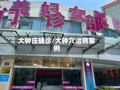 大钟庄确诊/大钟穴治病案例