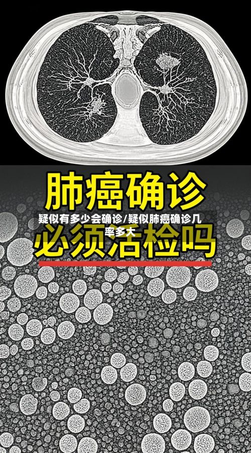 疑似有多少会确诊/疑似肺癌确诊几率多大