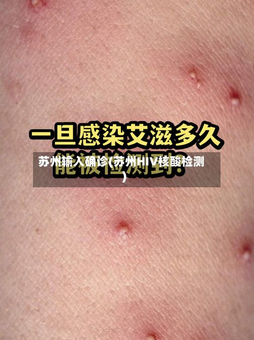 苏州输入确诊(苏州HIV核酸检测)-第2张图片