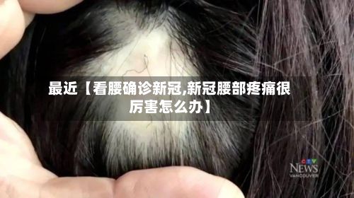 最近【看腰确诊新冠,新冠腰部疼痛很厉害怎么办】-第3张图片
