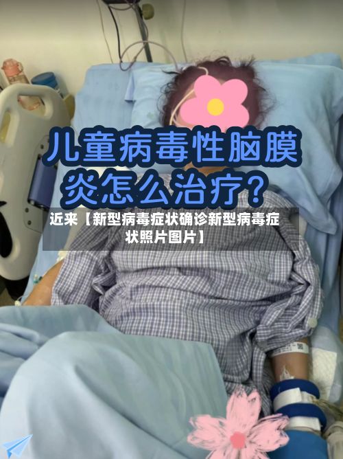 近来【新型病毒症状确诊新型病毒症状照片图片】