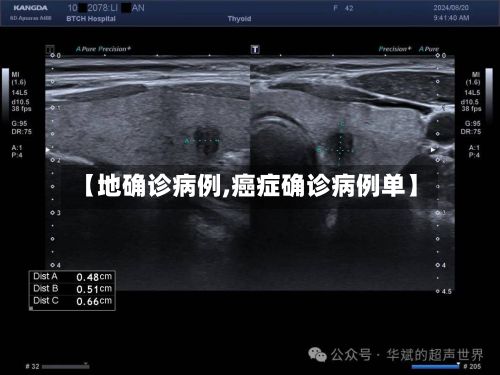 【地确诊病例,癌症确诊病例单】-第2张图片